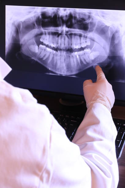 Best Emergency Denture Repair in Belgium, WI
